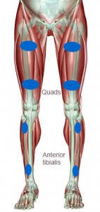 Anterior-leg-electrodes