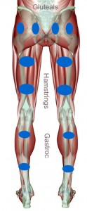 Posterior-leg-electrodes